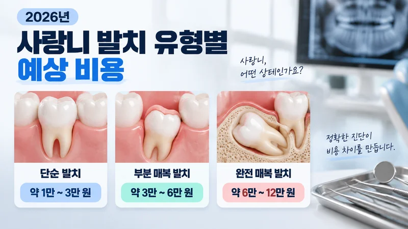 사랑니의 단순 발치, 부분 매복 발치, 완전 매복 발치 유형별 예상 비용 차이를 치아 모형으로 비교한 이미지