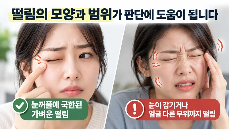 눈꺼풀에 국한된 가벼운 떨림과 눈이 감기거나 얼굴 다른 부위까지 이어지는 떨림을 비교한 이미지